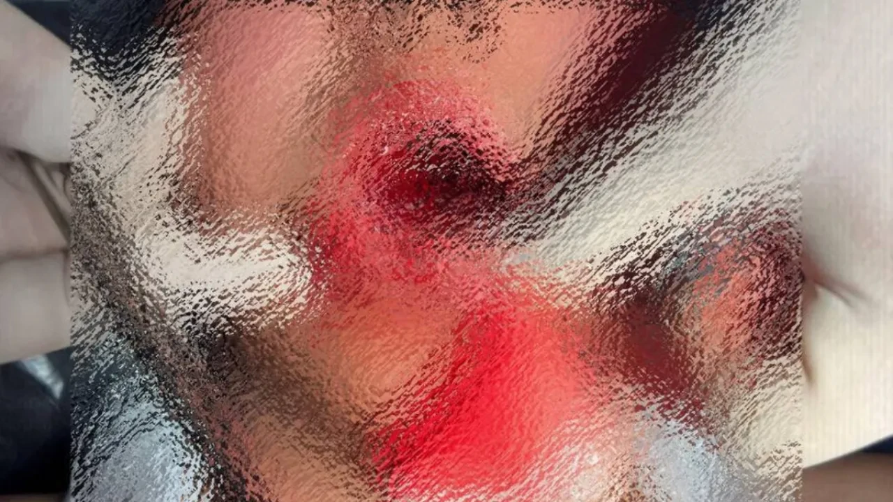 Қырғызстанда 18 жастағы қыз сүйісу кезінде жігіттің тілін тістеп жұлып алған