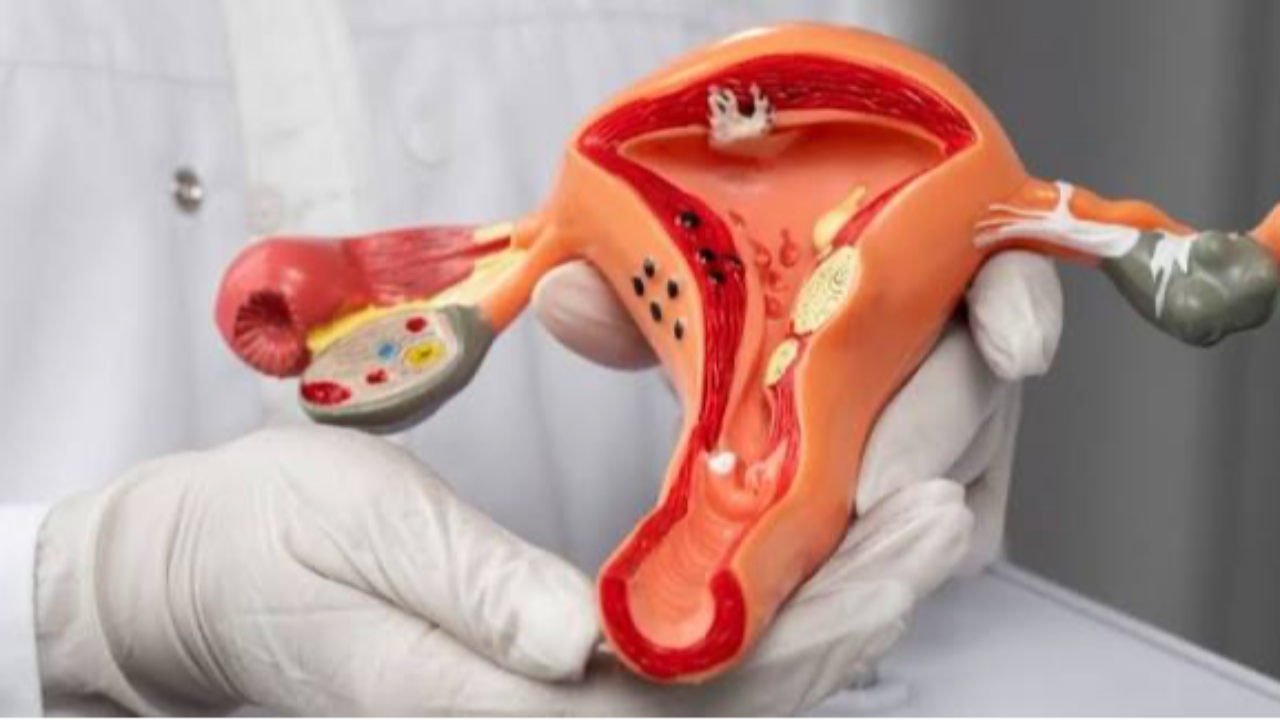 Жыл сайын Қазақстанда 600-ден астам әйел жатыр мойны обырынан қайтыс болады