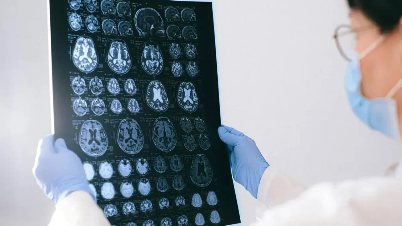 В Казахстане разрабатывают препарат для раннего выявления болезни Паркинсона и Альцгеймера