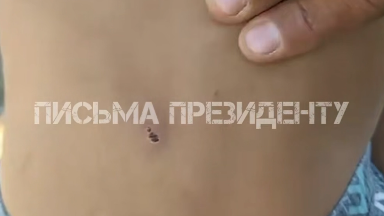 “Көмектеспесеңіздер біреуіміз өлеміз”,- Жамбылда өгей әкеден қорлық көрген екі бала көмек сұрады