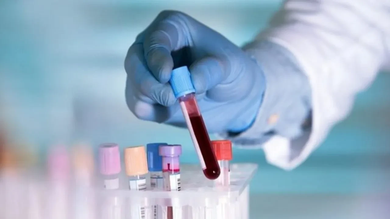 Өзбекстанда 90 күннен астам шетелде болған азаматтар ВИЧ-ке тексеріледі