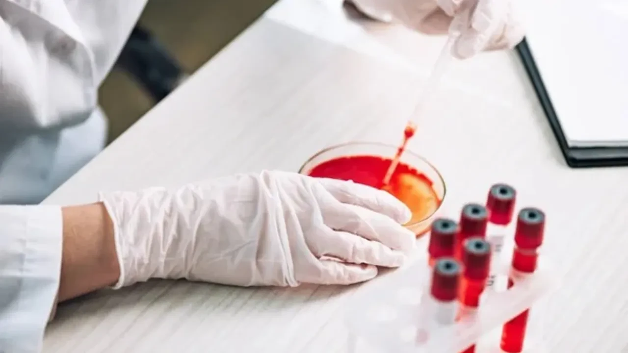 Смертность до 75%: ВОЗ предупредила об опасности вируса Нипах