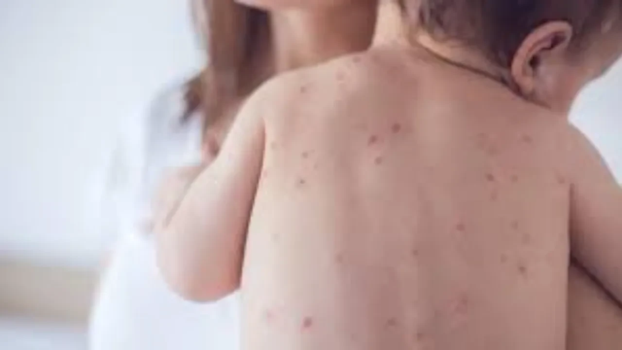 В Казахстане число "антиваксеров" выросло в 5 раз за восемь лет