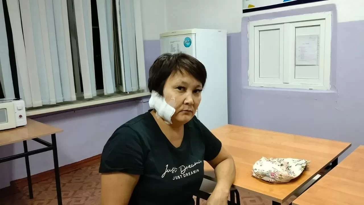 Шығыс Қазақстанда ер адам бұрынғы әйелінің құлағын кесіп тастады